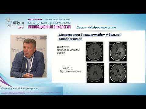 Видео: Современные терапевтические возможности лечения рецидивных злокачественных глиом.