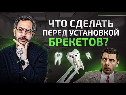 Видео: НЕЛЬЗЯ ставить брекеты пока не сделал ЭТОГО...