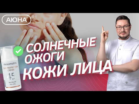 Видео: Солнечные ожоги кожи лица: что делать? Советы косметолога.