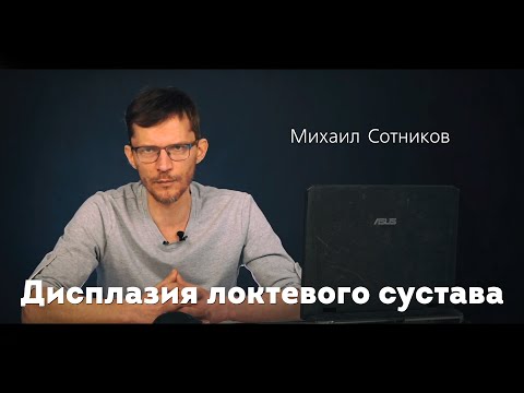 Видео: Дисплазия локтевого сустава