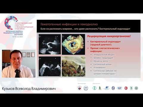 Видео: Катетер инфекция Кузьков В.В.
