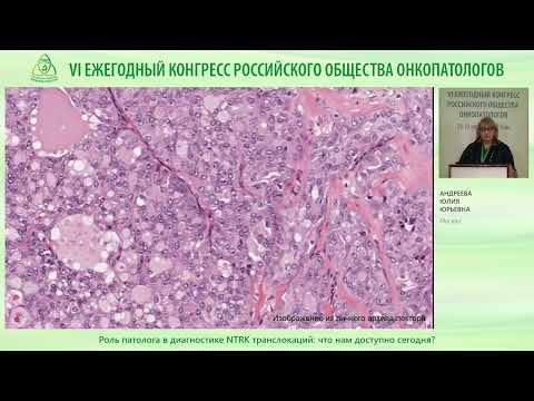 Видео: Роль патолога в диагностике NTRK транслокаций: что нам доступно сегодня?
