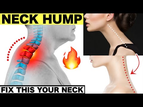 Видео: Как исправить горб на шее｜Можно делать сидя или стоя