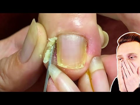 Видео: Попробуй не скажи ОЙ! / РЕАКЦИЯ на САМОЕ НЕ ПРИЯТНОЕ ВИДЕО в МИРЕ