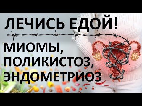 Видео: Эндометриоз, поликистоз и миома - не приговор! Излечись питанием!