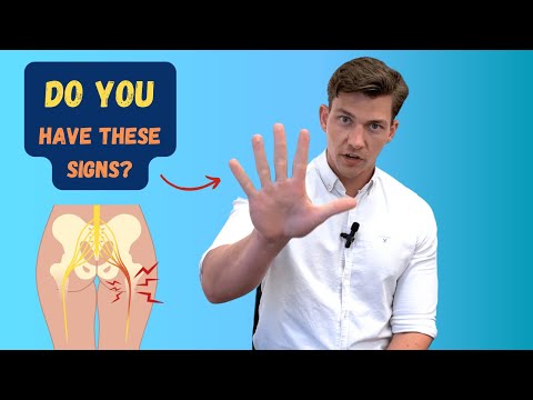 Видео: 5 признаков «серьёзного» ишиаса, на которые следует обратить внимание!