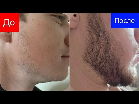 Видео: Как я запустил рост бороды. Личный опыт минокс выпуск 84 Андрей Борода 