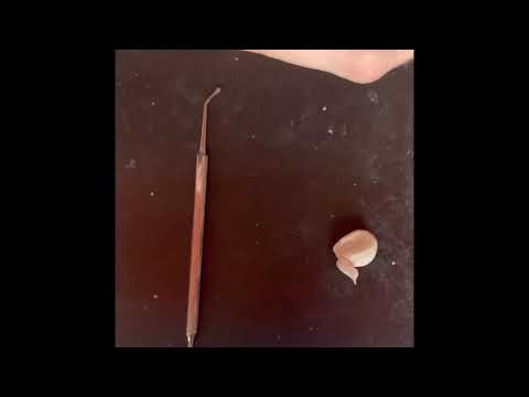 Видео: Первый моляр в/ч 2