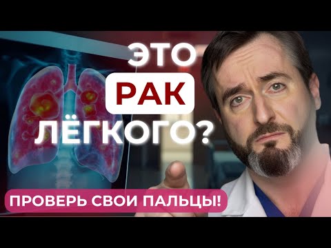 Видео: 5 признаков рака лёгких, которые легко пропустить!
