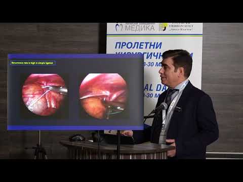 Видео: 37. Лапароскопско възстановяване на ингвинална херния: Да се прави или не?, Laparoscopic Inguinal ..