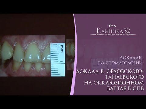 Видео: ✋🧾 Доклад В. Ордовского-Танаевского на Окклюзионном баттле в СПб