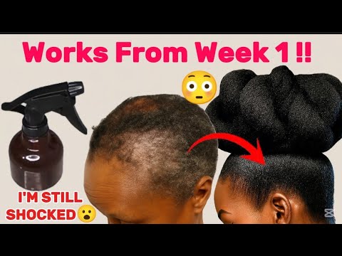 Видео: Самые легендарные травы, которые вызывают экстремальный рост и густоту волос за 2 недели!