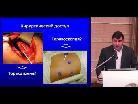 Видео: IA/AB стадии НМРЛ