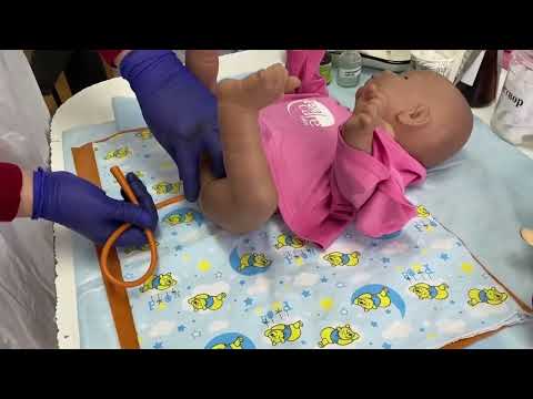 Видео: Метеоризм. Алгоритм постановки газоотводной трубки