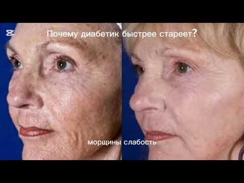 Видео: Почему диабетик стареет быстрее? #сахарныйдиабет 