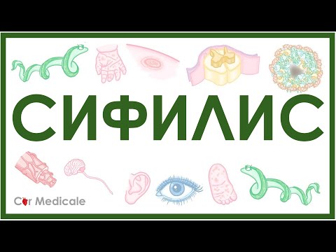 Видео: Сифилис - этиология, стадии, причины, симптомы, диагностика, лечение