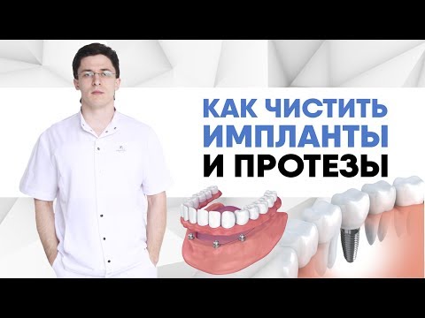 Видео: Как чистить импланты и протезы. Чем чистить импланты? Надо ли чистить протез? Что, если не чистить?