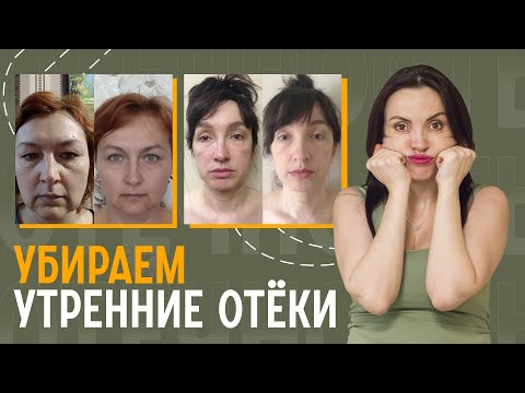 Видео: Причины появления отёков на лице. Лимфодренажные приёмы