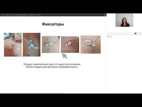 Видео: Уход и замена гастростомической трубки у пациентов со СМА
