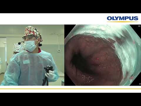 Видео: Осмотр пациента. С. В. Кашин