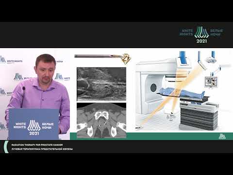 Видео: Стереотаксическая лучевая терапия рака предстательной железы (Новиков Р.В.)