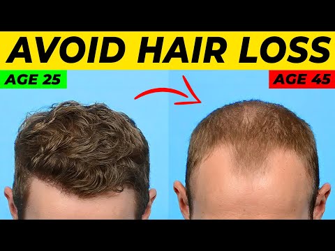 Видео: Местный финастерид от выпадения волос: что вам нужно знать