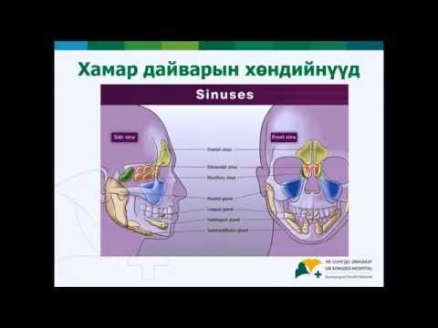 Видео: ЦУВРАЛ ЛЕКЦ - Чих хамар хоолой - Ю.Баянмөнх - Синусит