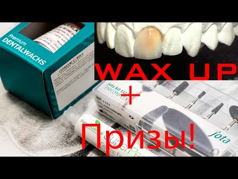 Видео: live Teeth Wax Up. Секреты Стоматологии