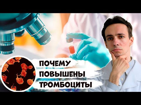 Видео: Почему повышены тромбоциты в анализе крови? Что делать? Советы врача