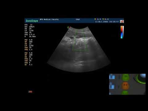 Видео: Практическое занятие  Допплерография брюшной аорты