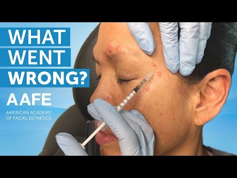 Видео: Корректирующая терапия ботоксом для Арлин | AAFE
