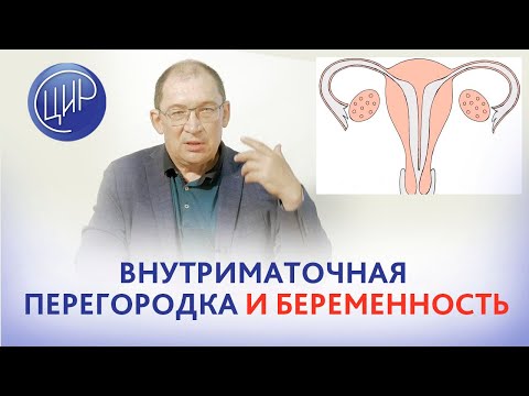 Видео: Внутриматочная перегородка, т-образная матка и синестрол при беременности. И.И. Гузов.