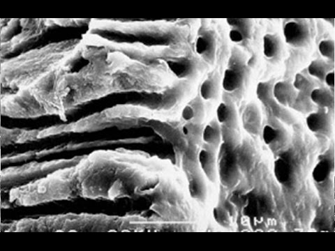 Видео: Промывание корневых каналов, протокол ирригации корневого канала, ирригация это...