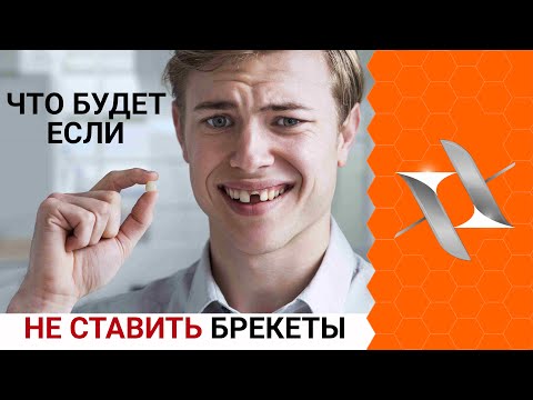 Видео: Что будет если НЕ СТАВИТЬ БРЕКЕТЫ? | 8  факторов риска