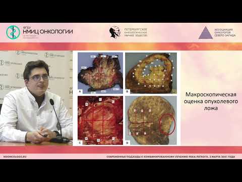 Видео: Оценка лечебного патоморфоза при немелкоклеточном раке легкого (Кушнарев В.А.)