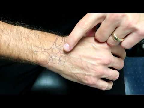 Видео: Как я вправляю запястье 💥Секреты ХИРОПРАКТИКА💥