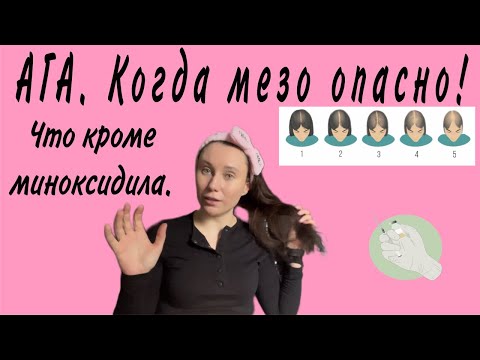 Видео: Андрогенная алопеция у женщин. Как уменьшить выпадение волос без миноксидила. Обязательно трихолог?