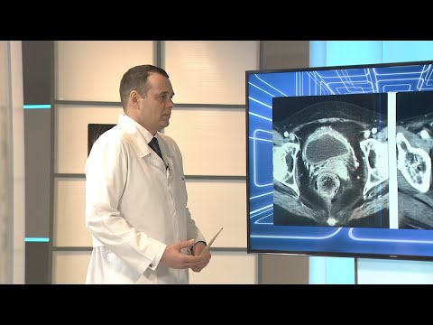 Видео: ПОСТЛУЧЕВОЙ ЦИСТИТ.