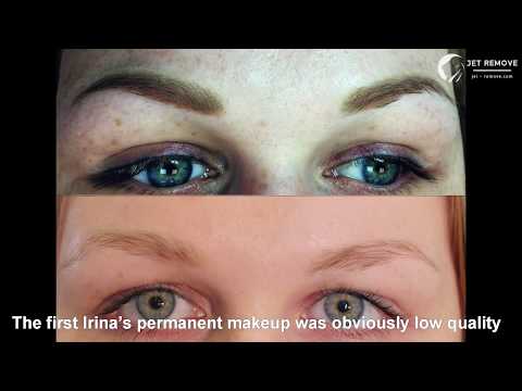Видео: Полное удаление татуажа бровей и век. Отзыв Ирины. Тату Ремувер Jet Remove. PMU tattoo remover