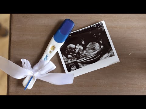 Видео: Я БЕРЕМЕННА 🤰🏼/РЕАКЦИИ РОДИТЕЛЕЙ/ МОЙ 1 ТРИМЕСТР/ ПЕРВЫЙ СКРИНИНГ