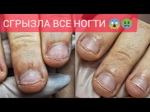 Видео: ГРЫЗУНЧИК🤢НОГТЕЙ ПОЧТИ НЕ ОСТАЛОСЬ 🤯😱