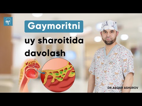 Видео: Gaymaritni uy sharoitida davolash / Лечение гайморита в домашних условиях | Dr. Ashurov