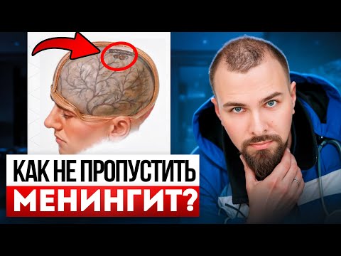 Видео: Как не пропустить МЕНИНГИТ? Кто его вызывает на самом деле?