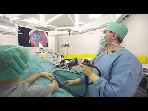 Видео: Удаление полипов толстой кишки