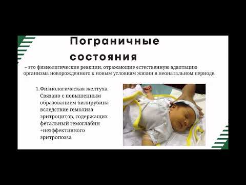 Видео: Пропедевтика детских болезней. Сбор анамнеза. Пограничные состояния новорожденных