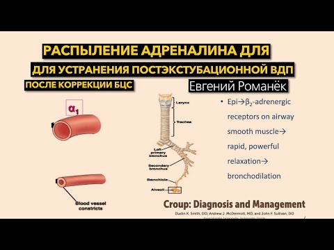 Видео: Распыление адреналина для устранения постэкстубационной обструкции ВДП после коррекции БЦС