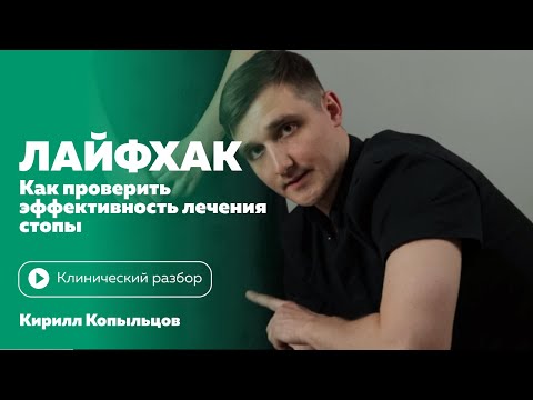 Видео: КАК ПРОВЕРИТЬ ЭФФЕКТИВНОСТЬ ЛЕЧЕНИ СТОПЫ | Лайфхак от Кирилла Копыльцова.