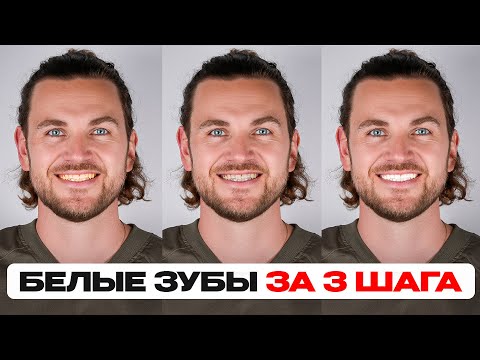 Видео: Спорим, вы НЕ ЗНАЛИ этого об отбеливании?