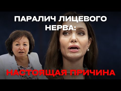Видео: ПАРАЛИЧ ЛИЦЕВОГО НЕРВА: НАСТОЯЩАЯ ПРИЧИНА