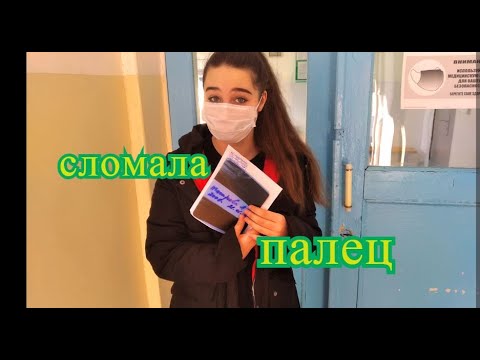 Видео: СЛОМАЛА ПАЛЕЦ.
